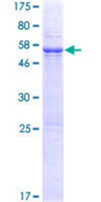 12.5% SDS-PAGE Stained with Coomassie Blue.