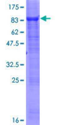 12.5% SDS-PAGE Stained with Coomassie Blue.