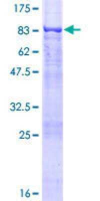 12.5% SDS-PAGE Stained with Coomassie Blue.