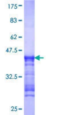 Other Recombinant Human RIOK1 GST (N-Term) Protein