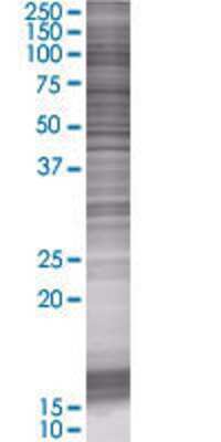 ZNF484 transfected lysate.