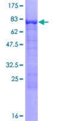 12.5% SDS-PAGE Stained with Coomassie Blue.