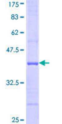 12.5% SDS-PAGE Stained with Coomassie Blue.