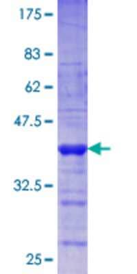 12.5% SDS-PAGE Stained with Coomassie Blue.