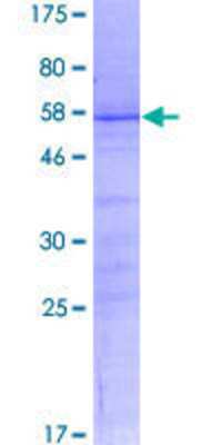 12.5% SDS-PAGE Stained with Coomassie Blue.