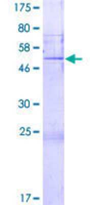 12.5% SDS-PAGE Stained with Coomassie Blue.