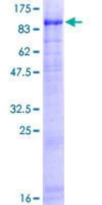 Other Recombinant Human USP44 GST (N-Term) Protein