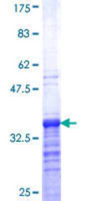 12.5% SDS-PAGE Stained with Coomassie Blue.