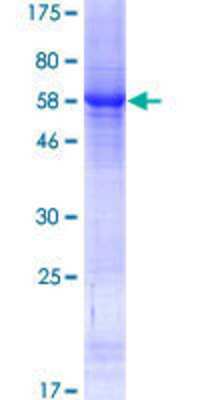 Other Recombinant Human LRRIQ1 GST (N-Term) Protein