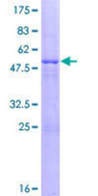 12.5% SDS-PAGE Stained with Coomassie Blue.