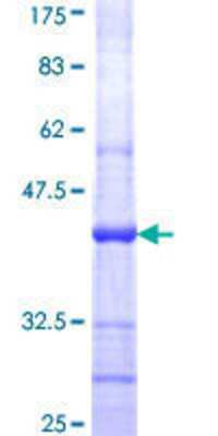 12.5% SDS-PAGE Stained with Coomassie Blue.