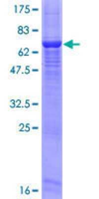 12.5% SDS-PAGE Stained with Coomassie Blue.
