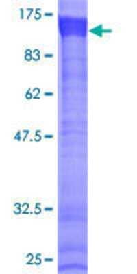 SDS-Page: Recombinant Human RKHD3 Protein [H00084206-P01] - 12.5% SDS-PAGE Stained with Coomassie Blue.