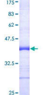 12.5% SDS-PAGE Stained with Coomassie Blue.