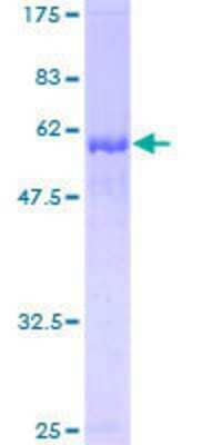 Other Recombinant Human EI2BL GST (N-Term) Protein