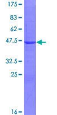 Other Recombinant Human bcl10-interacting CARD protein GST (N-Term) Protein