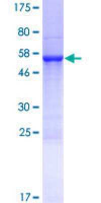 12.5% SDS-PAGE Stained with Coomassie Blue.