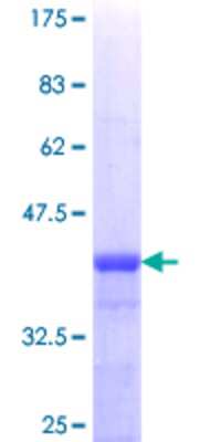 12.5% SDS-PAGE Stained with Coomassie Blue.