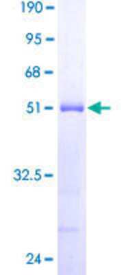 SDS-PAGE Recombinant Human DYDC2 GST (N-Term) Protein