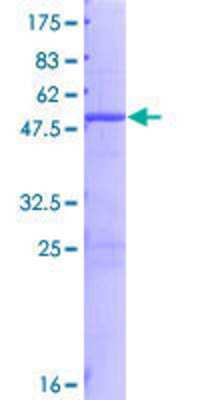 12.5% SDS-PAGE Stained with Coomassie Blue.