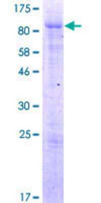 12.5% SDS-PAGE Stained with Coomassie Blue.