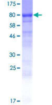 12.5% SDS-PAGE Stained with Coomassie Blue.