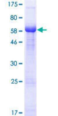 12.5% SDS-PAGE Stained with Coomassie Blue.