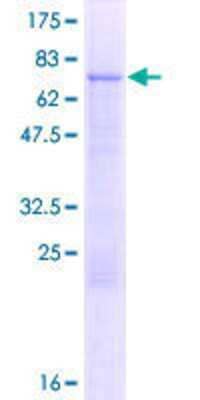 Recombinant Human LCoR Protein [H00084458-P01] - 12.5% SDS-PAGE Stained with Coomassie Blue.
