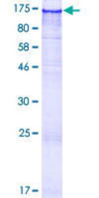 12.5% SDS-PAGE Stained with Coomassie Blue.