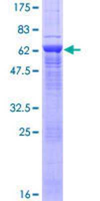 Other Recombinant Human ARPM1 GST (N-Term) Protein