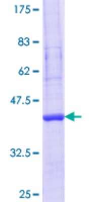 12.5% SDS-PAGE Stained with Coomassie Blue.