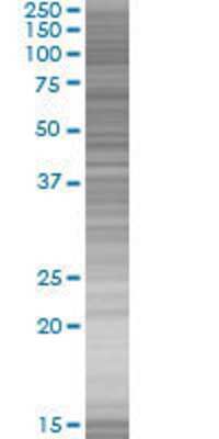 ZNF559 transfected lysate.