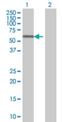 Lane 1: ZNF559 transfected lysate (62.3 KDa) Lane 2: Non-transfected lysate.