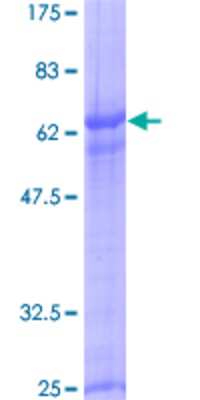 SDS-Page: Recombinant Human RHOXF2 Protein [H00084528-P01] - 12.5% SDS-PAGE Stained with Coomassie Blue.