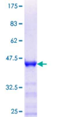 SDS-Page: Recombinant Human RHOXF2 Protein [H00084528-Q01] - 12.5% SDS-PAGE Stained with Coomassie Blue.