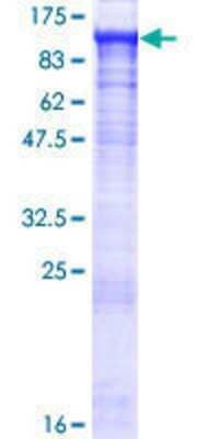 12.5% SDS-PAGE Stained with Coomassie Blue.