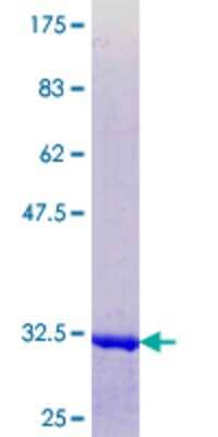 12.5% SDS-PAGE Stained with Coomassie Blue.