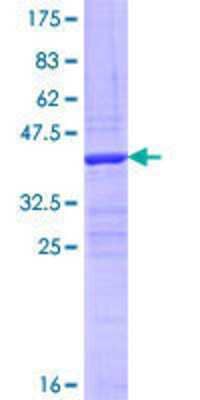 12.5% SDS-PAGE Stained with Coomassie Blue.