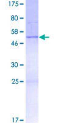 SDS-Page: Recombinant Human EVG1 Protein [H00084645-P01] - 12.5% SDS-PAGE Stained with Coomassie Blue.
