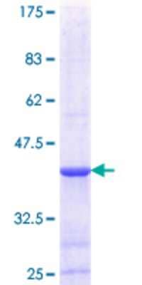 12.5% SDS-PAGE Stained with Coomassie Blue.