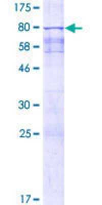 12.5% SDS-PAGE Stained with Coomassie Blue.