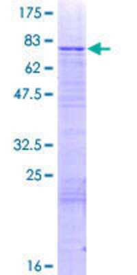 12.5% SDS-PAGE Stained with Coomassie Blue.