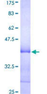 12.5% SDS-PAGE Stained with Coomassie Blue.