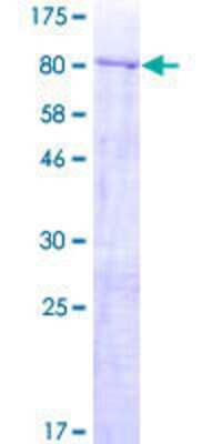 12.5% SDS-PAGE Stained with Coomassie Blue.