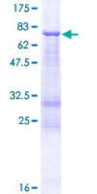 12.5% SDS-PAGE Stained with Coomassie Blue.