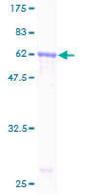 12.5% SDS-PAGE Stained with Coomassie Blue.