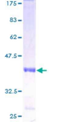 12.5% SDS-PAGE Stained with Coomassie Blue.