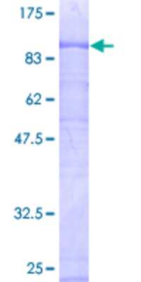 12.5% SDS-PAGE Stained with Coomassie Blue.