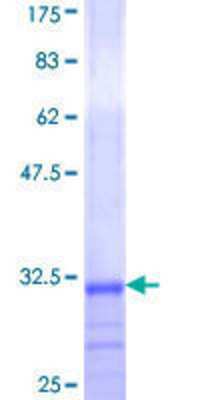 12.5% SDS-PAGE Stained with Coomassie Blue.