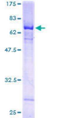 12.5% SDS-PAGE Stained with Coomassie Blue.